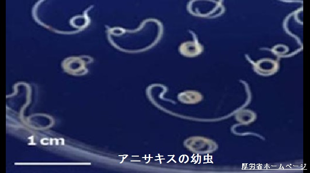 寄生虫のアニサキスが原因の食中毒が増えている