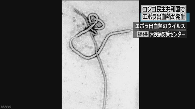 コンゴ民主共和国でエボラ出血熱 1人が亡くなる