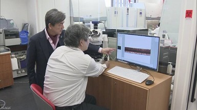髪の毛で病気かどうかわかる新しい研究を始める