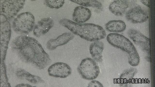 「はしか」が広がる心配があるためワクチンの注射を考えて