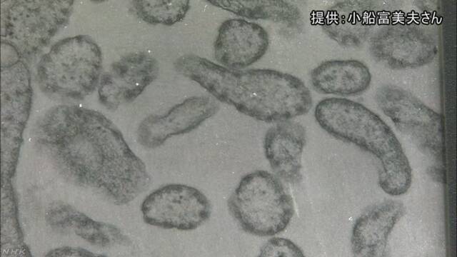 愛知県 女の子2人と赤ちゃんが「はしか」だとわかる