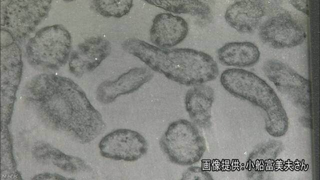 厚生労働省「東京都でもはしかになる人が増え始める」