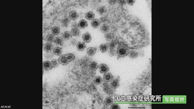 風疹になった人が東京都とその周りで増えている