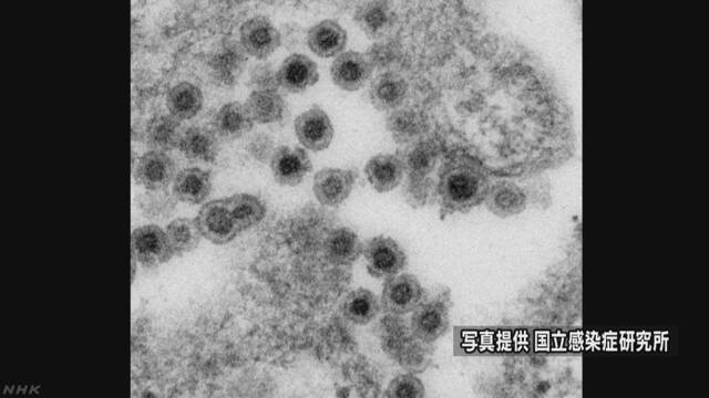 風疹になる人が今も多い 男性は女性の4.5倍