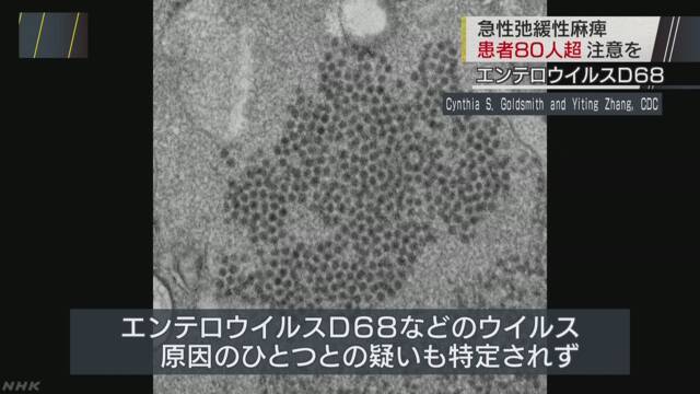 子どもが手や足に力が入らなくなる病気に気をつけて